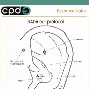 CPDG NADA Ear Acupuncture protocol