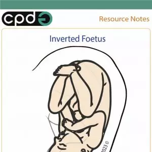 CPDG ear acupuncture inverted foetus