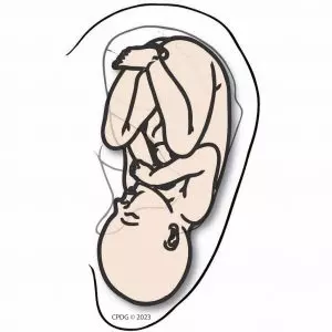 CPDG ear acupuncture integrating it into your practice