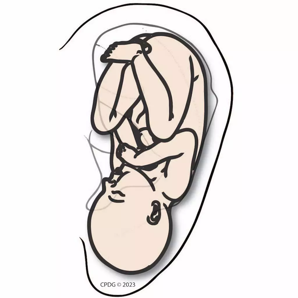 CPDG ear acupuncture integrating it into your practice