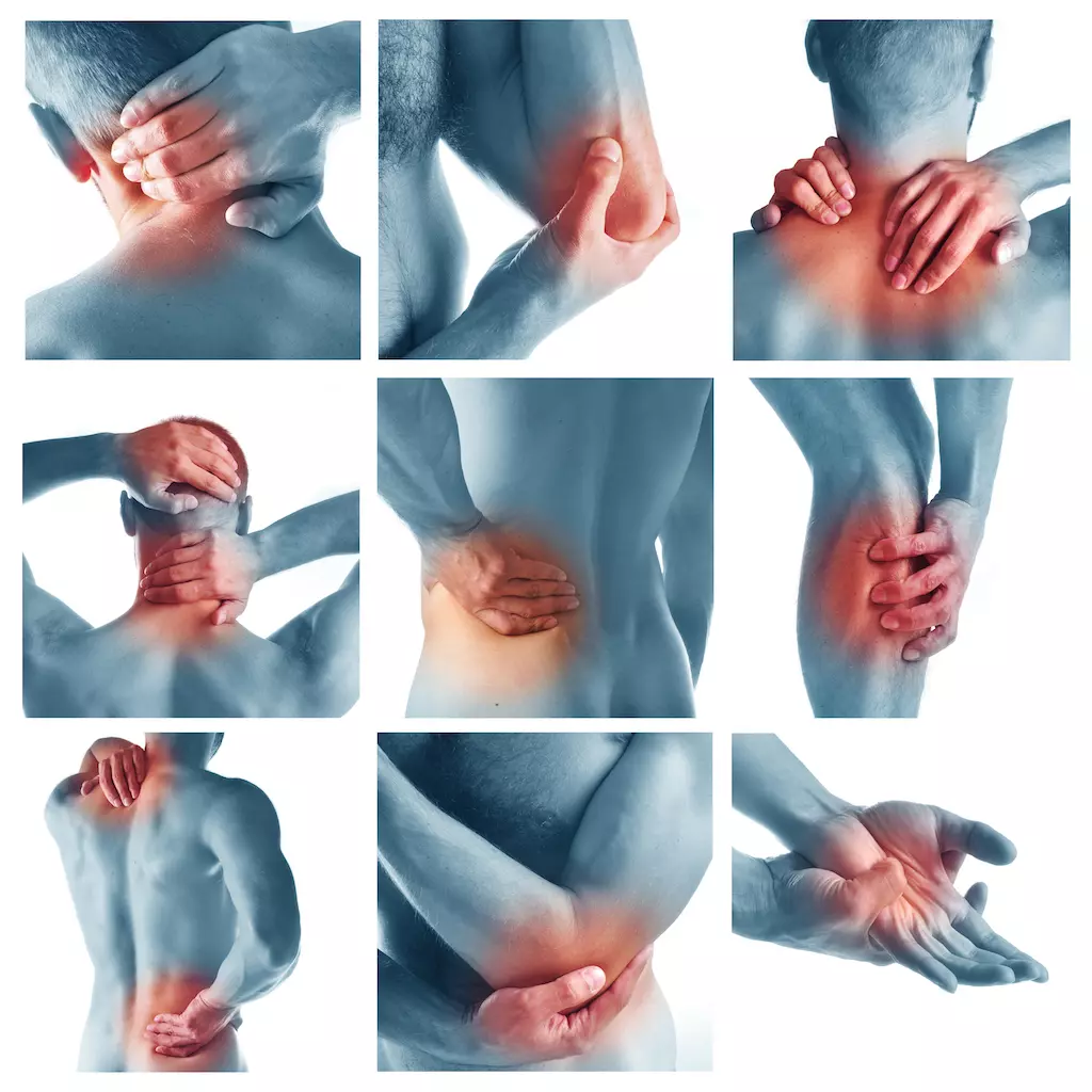 CPDG treating myofascial trigger points