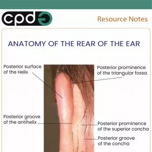 CPDG posterior of the ear
